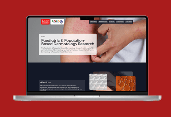 A laptop displaying a website for Paediatric and Population-Based Dermatology Research is shown against a red background. The screen features a close-up image of a person's arm with redness, indicating a skin condition. A hand is positioned nearby, possibly pointing or gesturing. The website header includes the King's College London logo and the acronym POPD, along with navigation buttons for projects, stories, publicity, and core team. Below the header, a section describes the research focus, and there are visual elements, including patterns