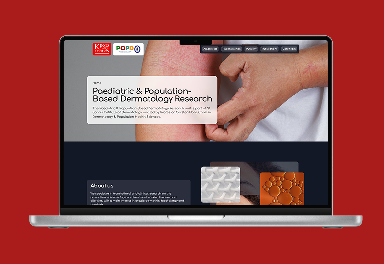 A laptop displaying a website for Paediatric and Population-Based Dermatology Research is shown against a red background. The screen features a close-up image of a person's arm with redness, indicating a skin condition. A hand is positioned nearby, possibly pointing or gesturing. The website header includes the King's College London logo and the acronym POPD, along with navigation buttons for projects, stories, publicity, and core team. Below the header, a section describes the research focus, and there are visual elements, including patterns